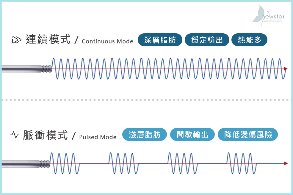 音浪抽脂5特色_雙音波