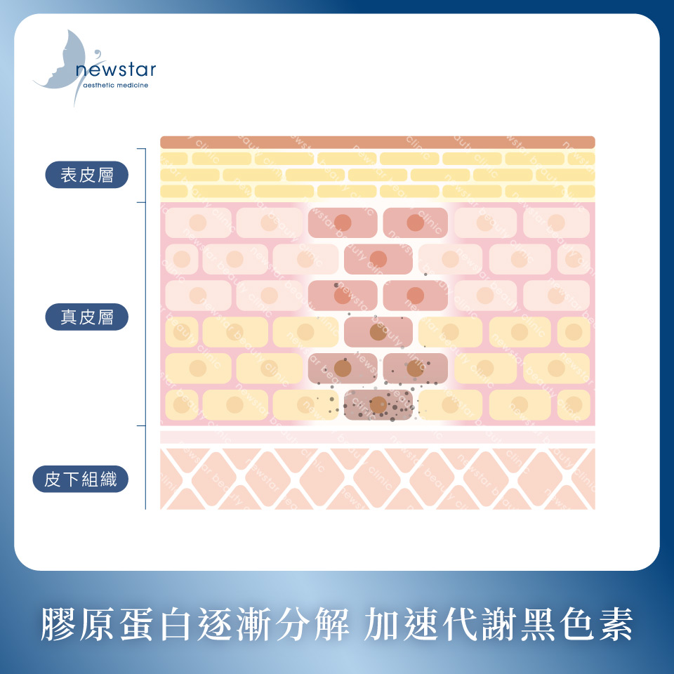 膠原蛋白熊貓針_亮白肌膚