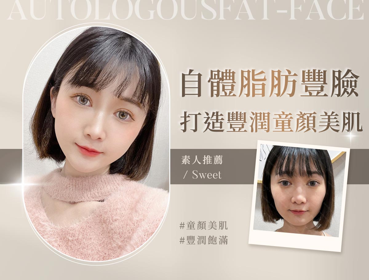 手術官網案例_外bn_甜天