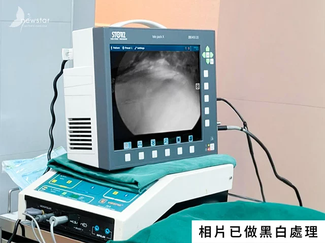 珍珠波 盈波隆乳_高階內視鏡設備