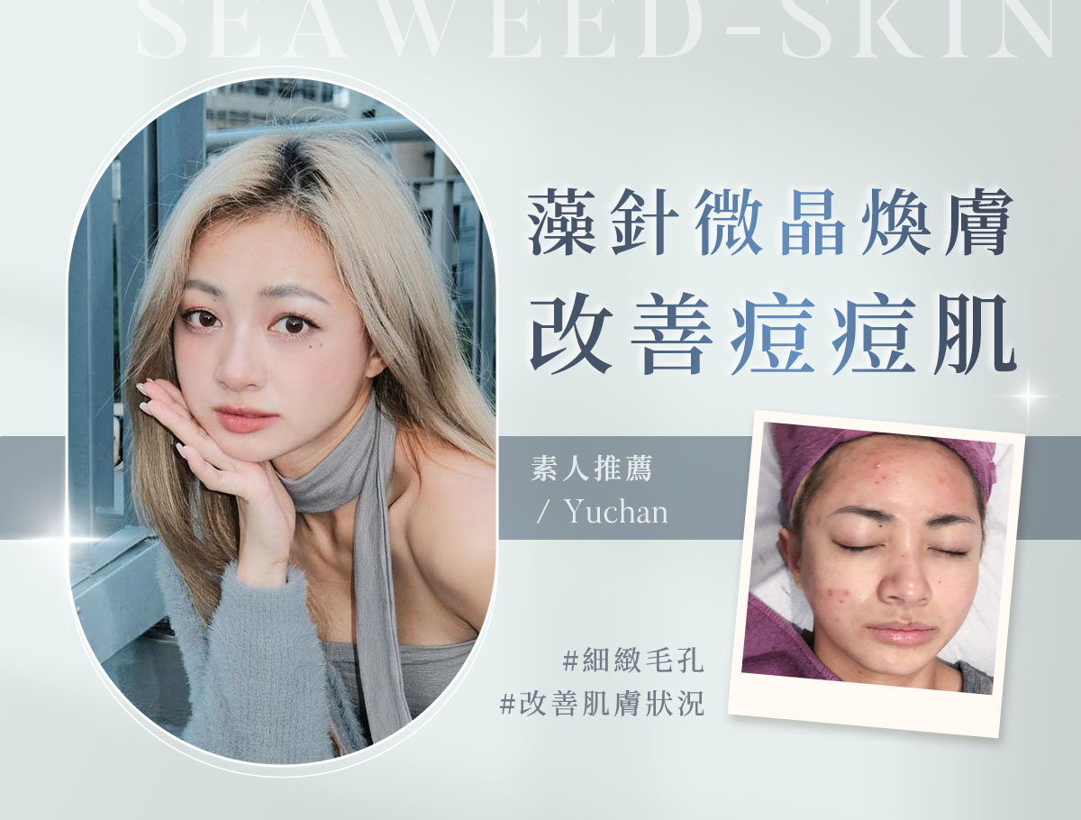 欣莘素人案例_羽珊