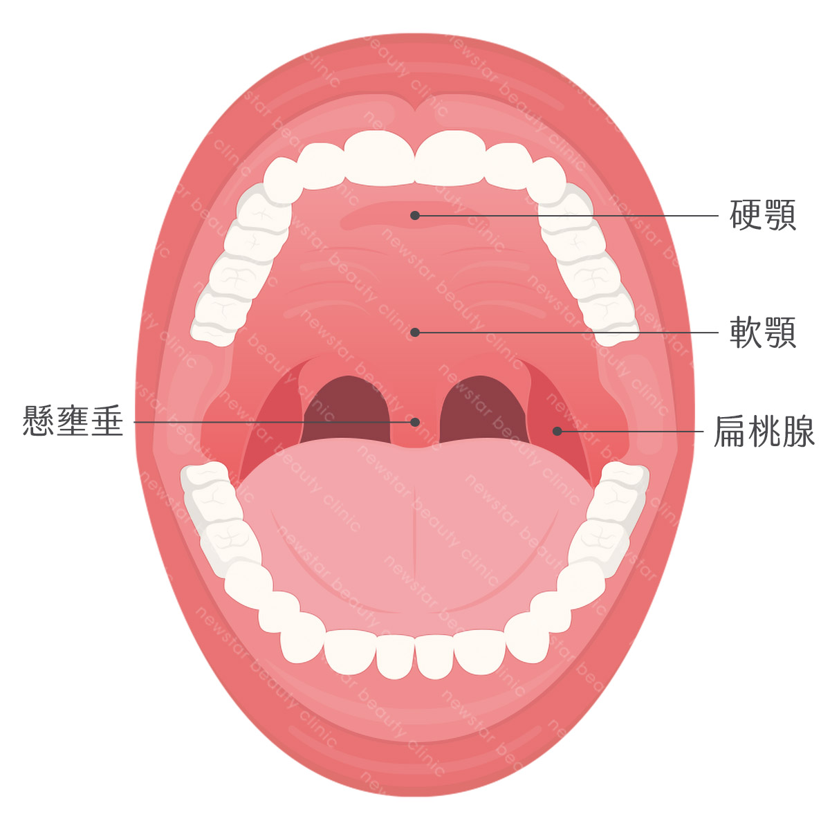 軟硬顎、扁桃腺、懸壅垂位置圖