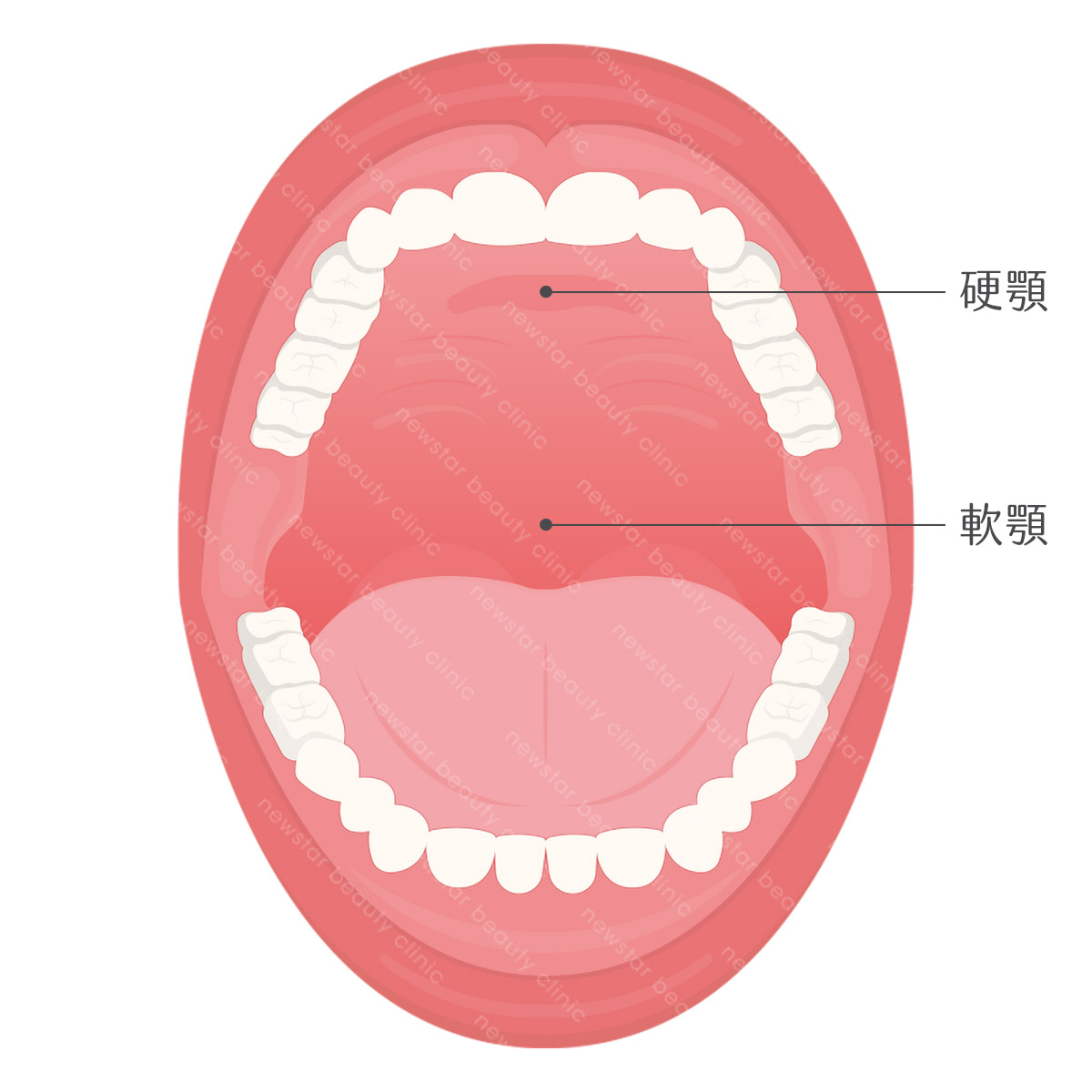 軟硬顎、扁桃腺、懸壅垂位置圖