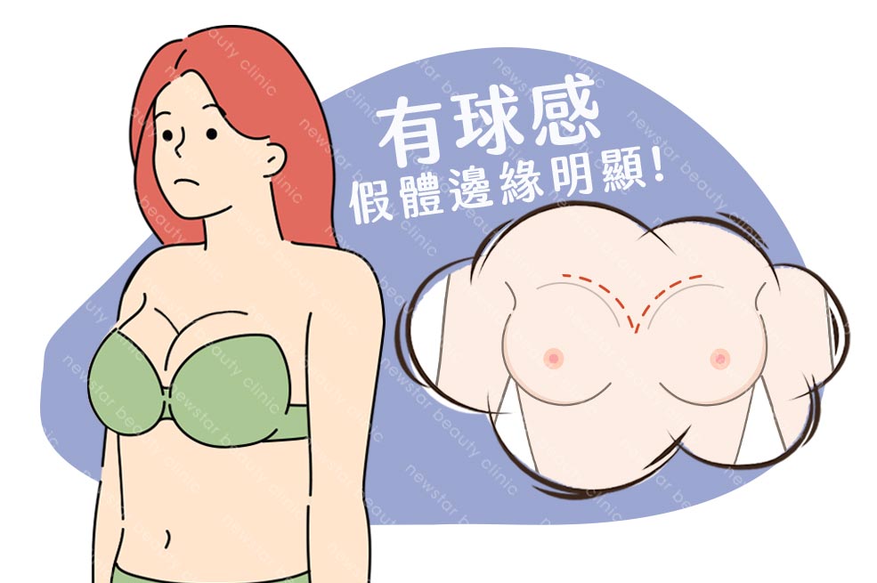 假體風險缺點_邊緣感07