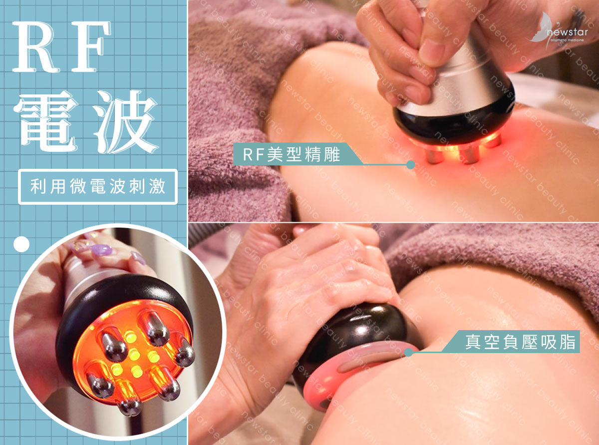 瘦小腿療程_RF電波