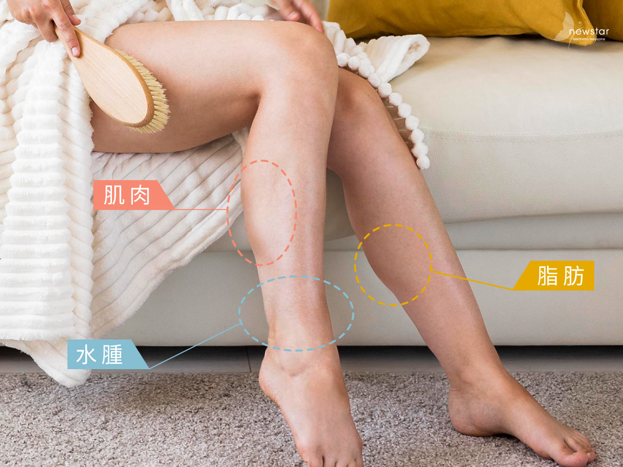 瘦小腿療程_混和性小腿照片